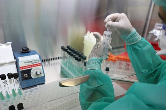 A new batch of reagents worth $1.3 million has been received for medical laboratories of Turkmenistan