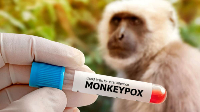  Russia has handed over tests to Turkmenistan to detect smallpox monkeys